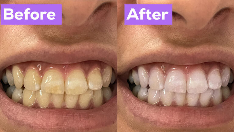 Original | Hismile v34 Colour Corrector & Instant Teeth Whitening